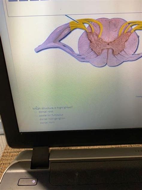 Solved Wilen Structure Is Highlighted Dorsal Root Posterior