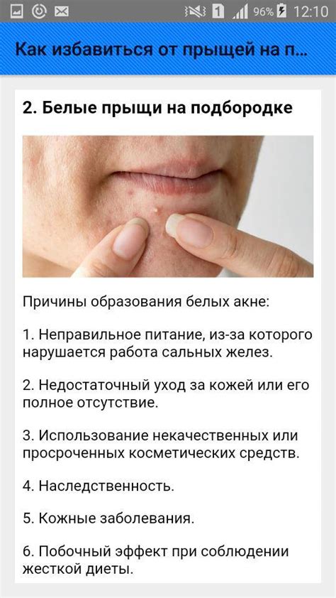 Как убрать подкожные прыщи на подбородке у женщин