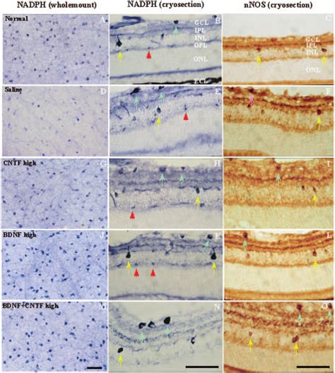 Photomicrographs Showing Nadph Diaphorase Staining In Retinal