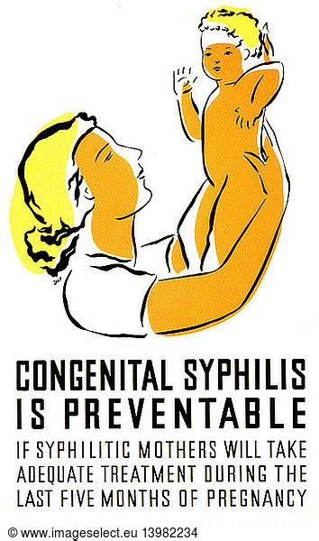 Syphilis Treatment Syphilis Treatment Fap Poster Alexander