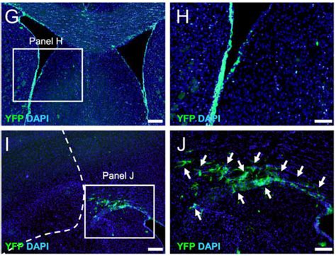 Ijms Free Full Text Establishment Of A Reproducible Ischemic Stroke