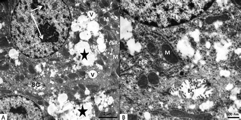 A Electron Micrograph Of Ultrathin Section Of The Group Received Vit