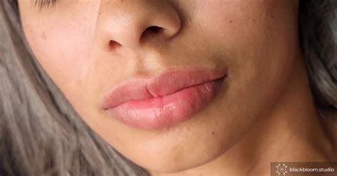 What Is Lip Blushing 2023 My Before After Pics And Side Effects