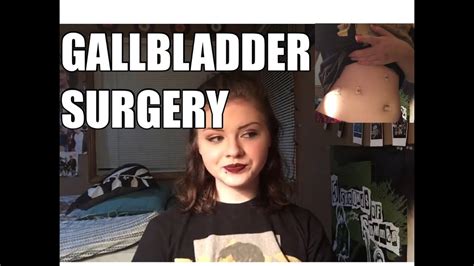 Story Time My Gallbladder Surgery Youtube