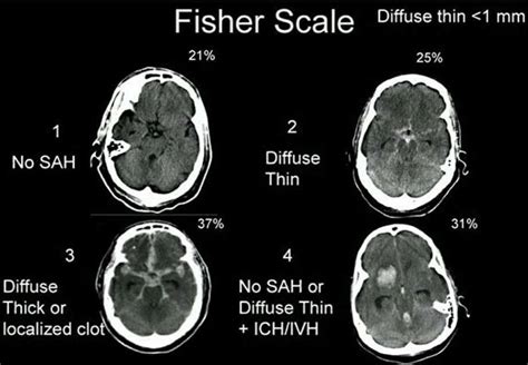 Pin By Aleksandra Stawik On Medyczne Radiology Imaging Medical