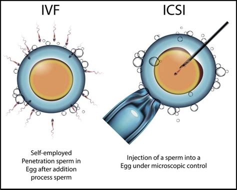 Ivf Treatment Center In Mumbai Ivf Treatment In Kandivali