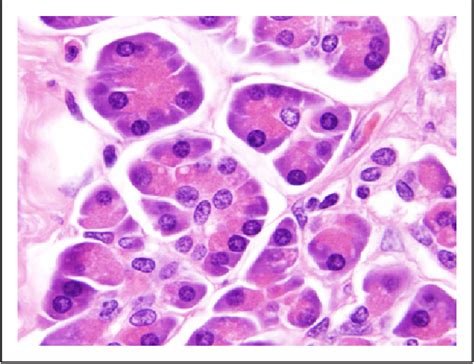 The Wonderful Colors Of The Hematoxylineosin Stain In Diagnostic