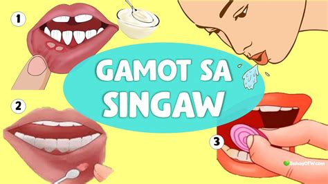 Singaw Mabisang Halamang Gamot Ano Bawal Pagkain Bakit Masakit