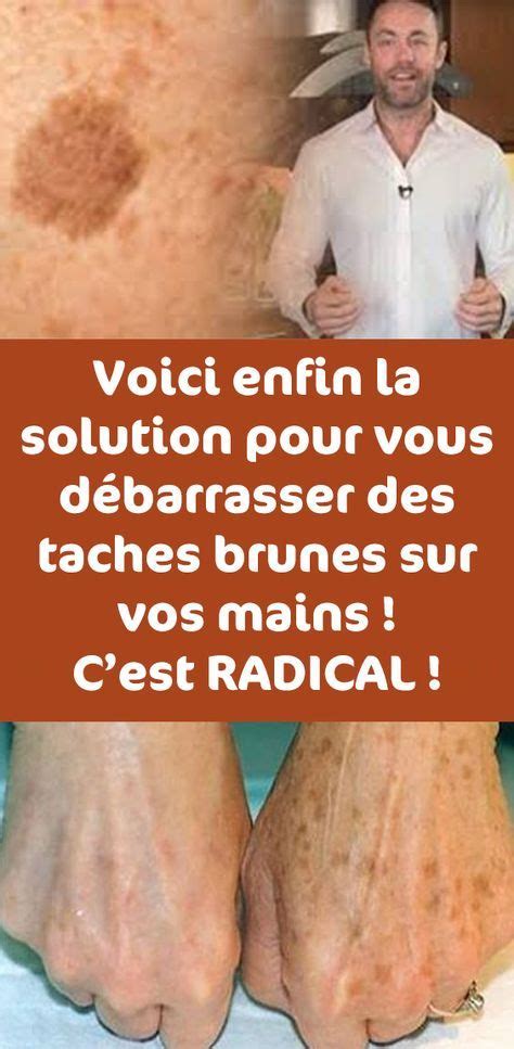 Voici enfin la solution pour vous débarrasser des taches brunes sur vos