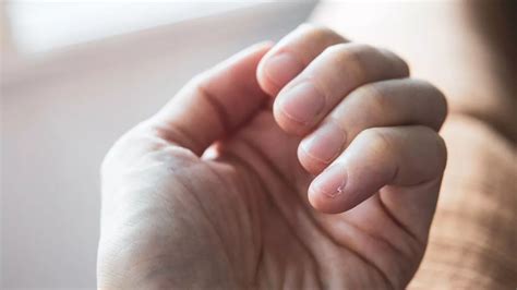 Vitamin B Deficiency Warning On Fingernail That Could Help Quick