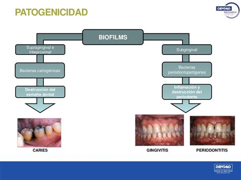 Estudio De Biofilms Bucales