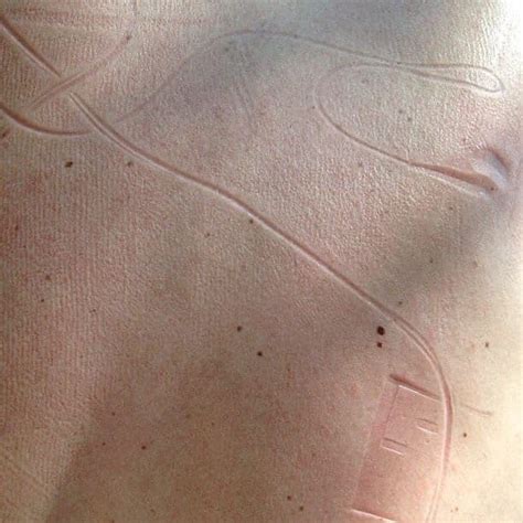 Pin On Aest Skin Marks Body Imprint Art Skin