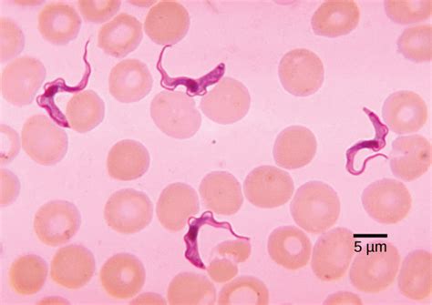 Pathogenic Protists | Biology for Majors II