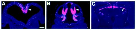 Control Of Hippocampal Morphogenesis And Neuronal Differentiation By