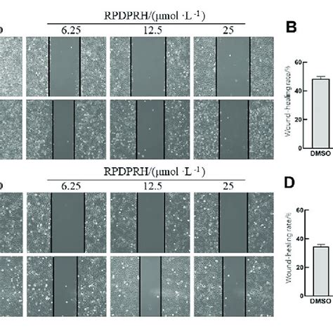 Effect Of RPDPRH On HepG2 And 7402 Cell Migration Note A Image Of