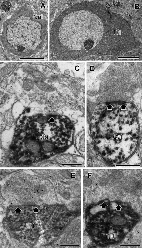 Electron Microscopic Photographs Showing Calbindin Cal A And Th B