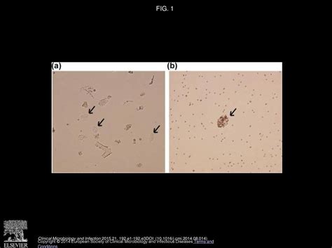 Whole Genome Sequencing Of Clinical Isolates Of Giardia Lamblia Ppt Download