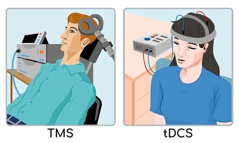 Tdcs Vs Tms Whats The Difference And Whats Best For You Caputron