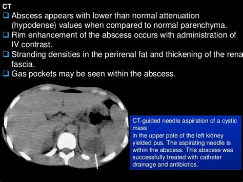 2 abdomen pathology ct