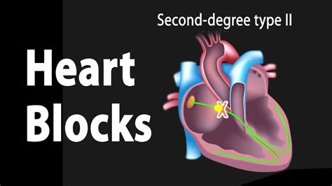 Heart Blocks Anatomy And Ecg Reading Animation Youtube