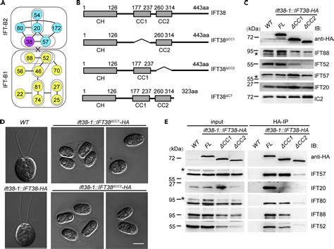 Assembly And Stability Of Ift B Complex And Its Function In Bbsome