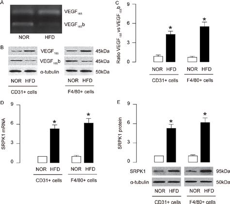 Figure 4 From Role Of Alternative Splicing Of VEGF A In The Development