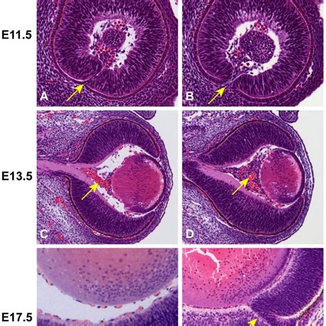 Histologic Sections Of Pax And Pax A G A G Mouse Eyes At Three