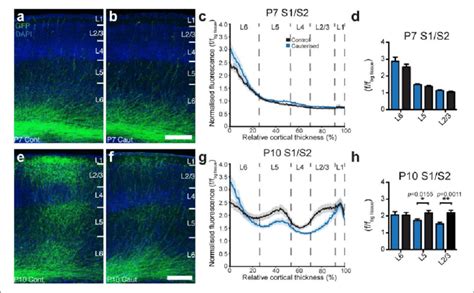 Unilateral Sensory Deprivation Inhibits Developmental Exuberance Of Download Scientific Diagram