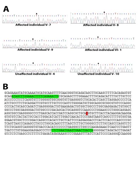 Mutation screening of the EDN3 gene in the family. A: Sequencing ...