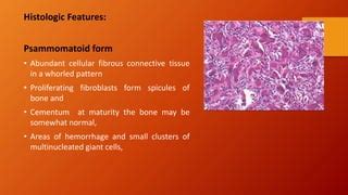 Juvenile Ossifying Fibroma Ppt