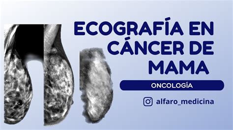 Ecografía en cáncer de mama YouTube