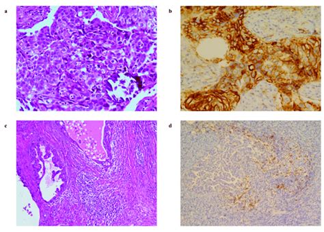 Representative Examples For Histological And Immunohistochemical