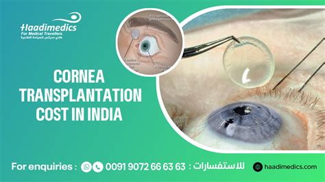 Cornea Transplant Surgery Cost In India