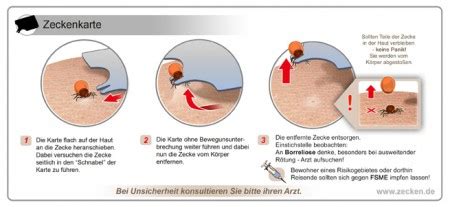 Zeckenentfernung Zeckenkarte Kindernotfall Bonn Erste Hilfe Am Kind