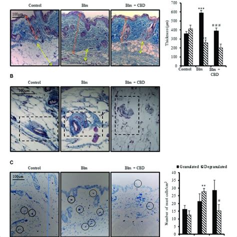 Treatment With CBD Reduced Skin Fibrosis Development In A Mouse Model