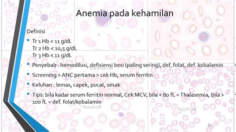 Anemia Pada Kehamilan Obgyn 13 UKMPPD UKDI Dokter YouTube