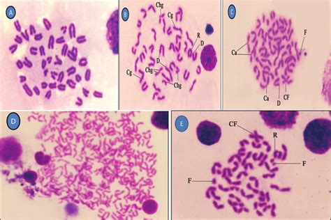 A Photomicrograph Of Metaphase Spreading From Rat Bone Marrow Showing