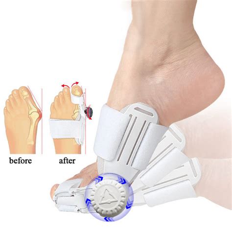 Jual Alat Pelurus Jempol Kaki Bunion Hallux Valgus Dengan Knob BJK P