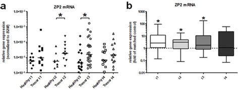 Cancers | Free Full-Text | Zona Pellucida Protein 2 (ZP2) Is Expressed ...