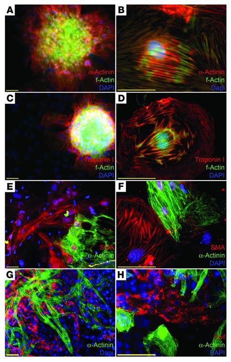 JCI Mouse ES Cellderived Cardiac Precursor Cells Are Multipotent And