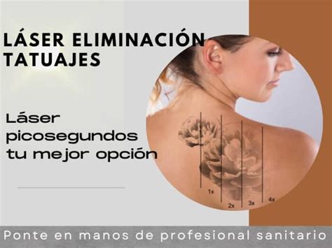 Eliminar tatuajes con Láser Cema Clínic Vilanova