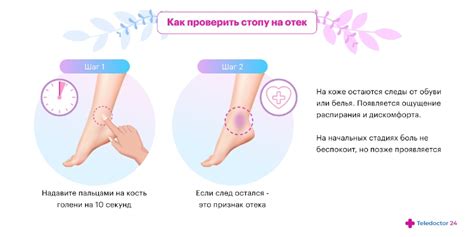 Что делать, если отекают ноги. Отечность ног — признаки, симптомы ...