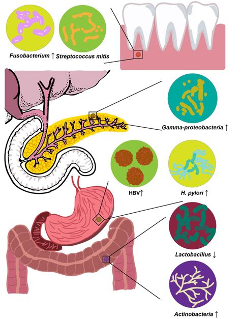 Specific Microbiota Associated With Pc Whose Abundances Increase