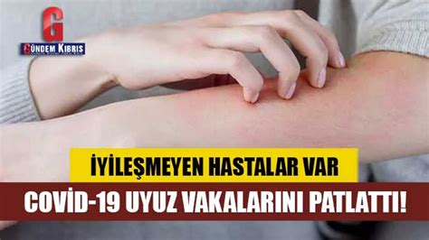 Uyuz hastalığı nedir belirtileri nelerdir Uyuz hastalığından nasıl