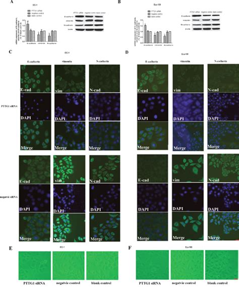 Pttg1 Cooperated With Gli1 Leads To Epithelial Mesenchymal Transition