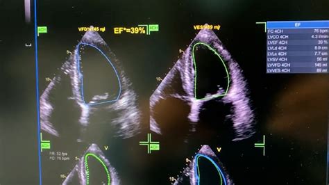 Crema Donato Un Ecocardiografo Per La Creazione Di Un Nuovo