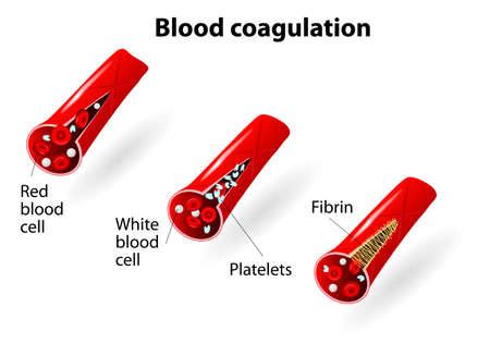 Vector of Process of blood coagulation - ID:17709305 - Royalty Free ...