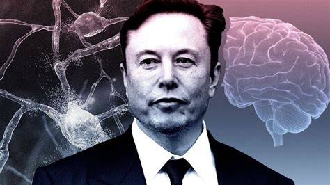 Kanada Beyin Ipi Denemesi I In Elon Musk N Neuralink Irketine Onay