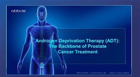 ADT as the Backbone for Combination Treatments in Advanced Prostate Cancer