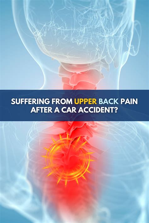 Upper Back Pain After Car Accident What You Need To Know